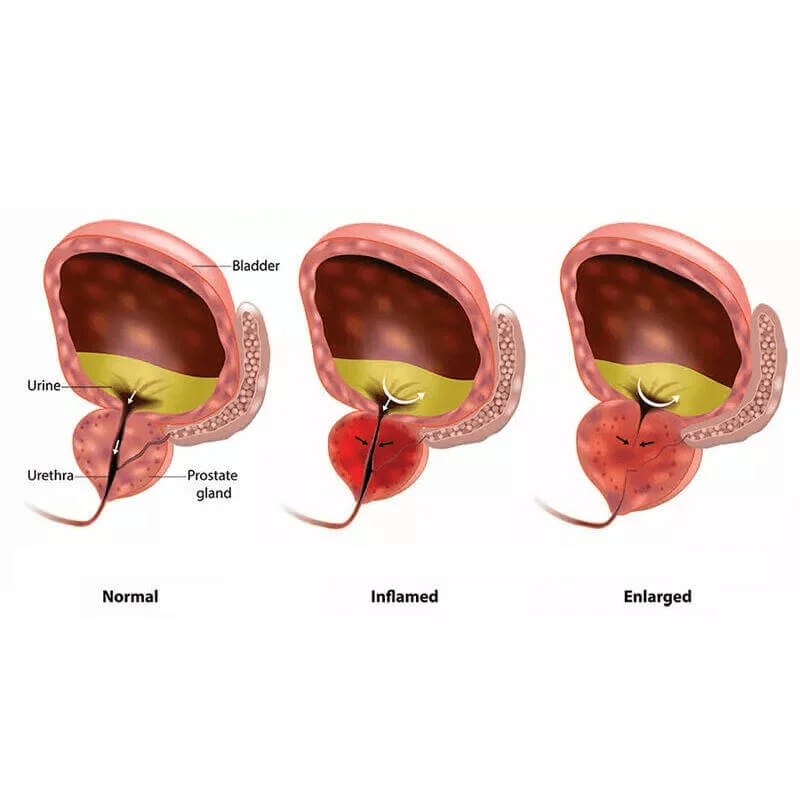 Prosta MD Prostate Multiphase Capsules